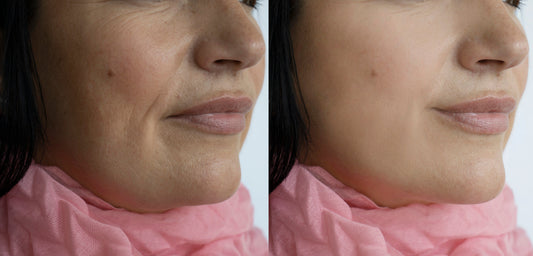 The Power of Peptides: More Than Just Building Blocks for Youthful Skin